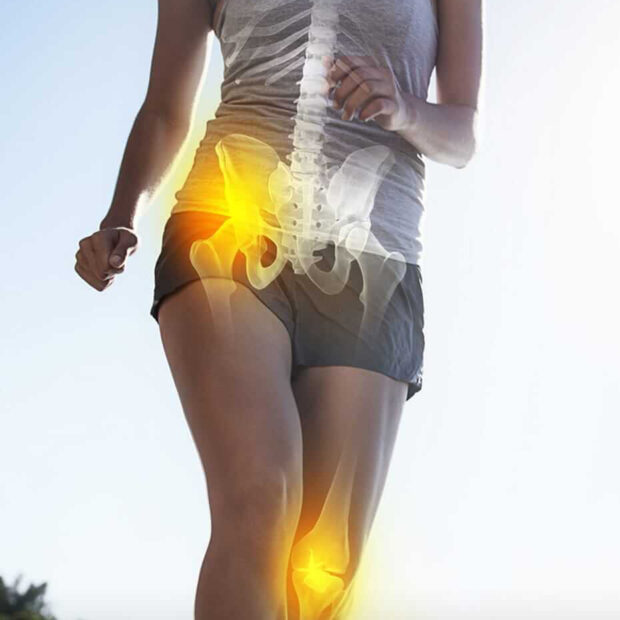 Joint Replacement Sugery